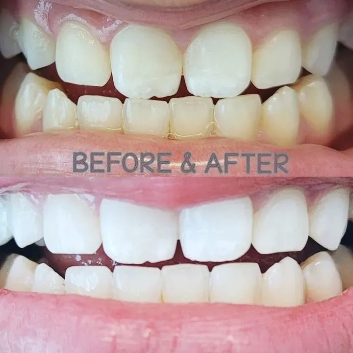 https://cdn.salonspotlight.com/photos/1KFjKA917tIOKaXfljd5/1e974725-7401-47e5-9473-0d8410427299_720x720