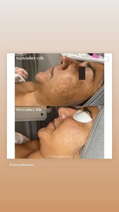 https://cdn.salonspotlight.com/photos/29LWXXXdZxwmWAeGirO5/01c9a726-aedb-406a-953b-c0859ce79663_720x720