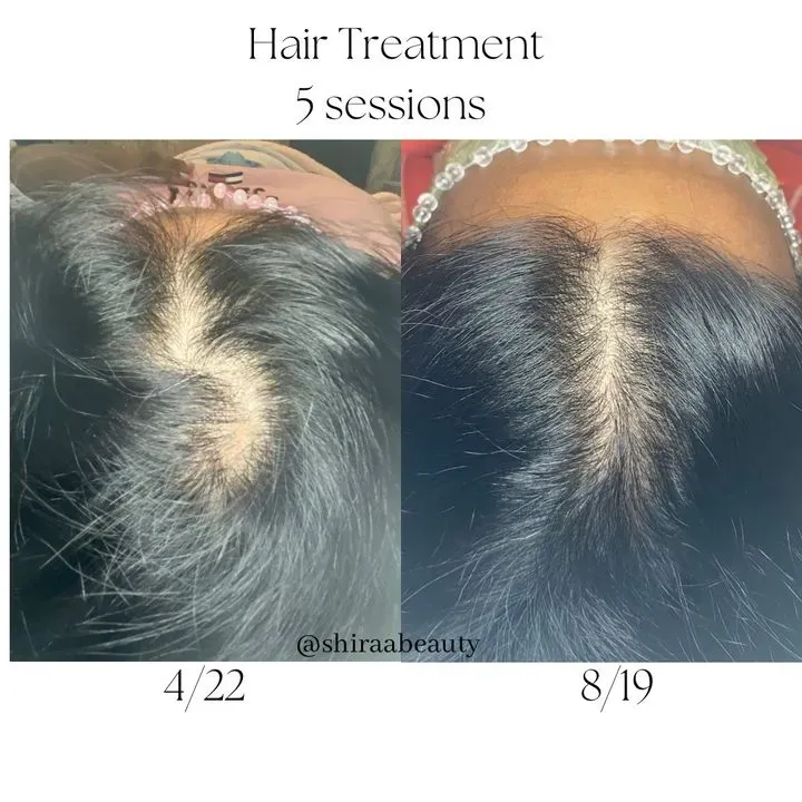 https://cdn.salonspotlight.com/photos/29LWXXXdZxwmWAeGirO5/eeeedc9e-a58e-4e5a-9f15-c5566c531c8b_720x720