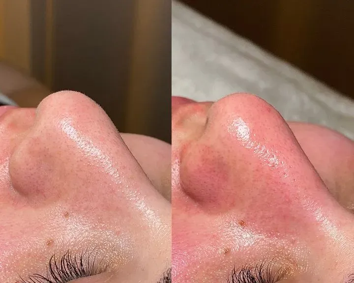 https://cdn.salonspotlight.com/photos/47ehKP91ZogXffnyT3RE/6be5e708-bc9e-4067-9246-726bb11f831b_720x720