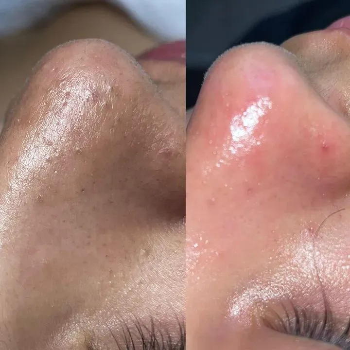 https://cdn.salonspotlight.com/photos/5I1Sq6BPsCaWCzH4sxaC/824cc107-2956-450b-aa23-0c1a16086e0b_720x720