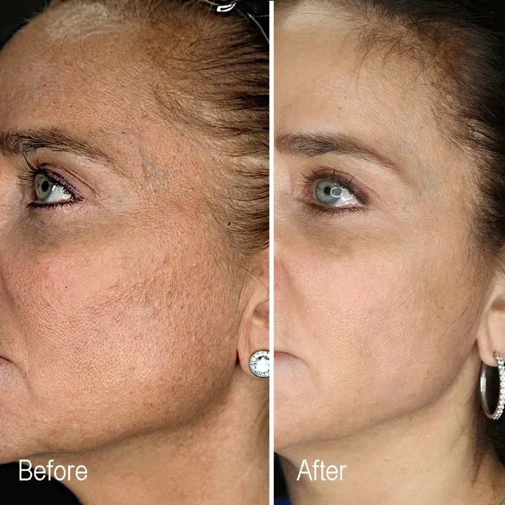 https://cdn.salonspotlight.com/photos/5bfkVMuhThCpS2txSJT9/a276367b-00eb-48ab-a824-4235ed772569_720x720