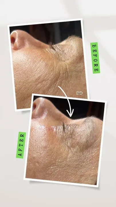 https://cdn.salonspotlight.com/photos/6MyErpdTmqSddaEspjkh/416205af-4175-4976-baf8-4412187810c2_720x720