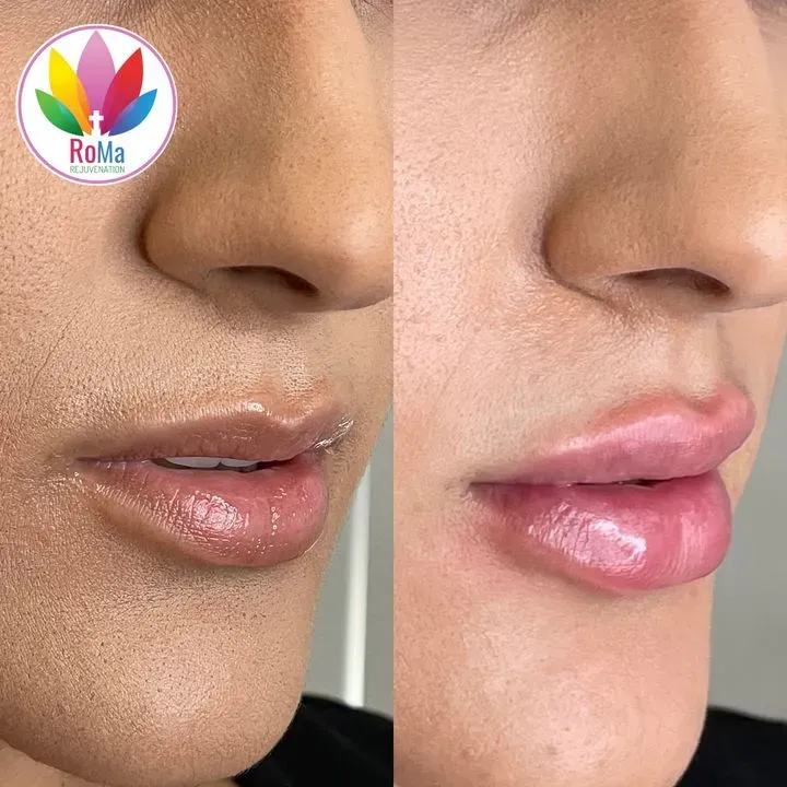 https://cdn.salonspotlight.com/photos/7gBH83clZy78cFYPTjLv/d432f67b-ab4b-45f7-8070-b124d1ed9deb_720x720