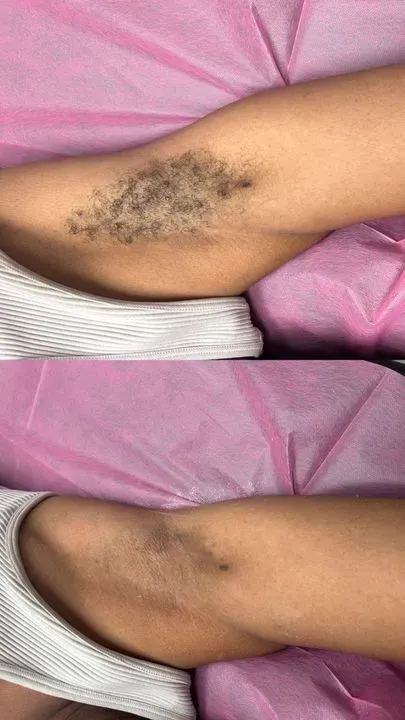 https://cdn.salonspotlight.com/photos/8VRdDMi03NjJmeOOJzb7/e4f9ac09-538c-4d16-829c-eed6283eba9c_720x720