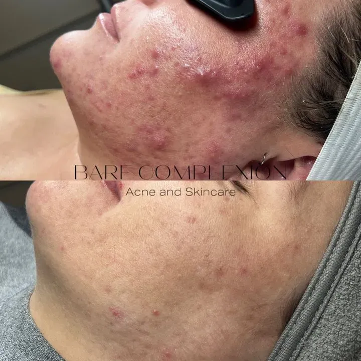 https://cdn.salonspotlight.com/photos/8pDDciJkrbnOhGfwMsAQ/15f606ce-683b-4804-b923-26549c875d80_720x720