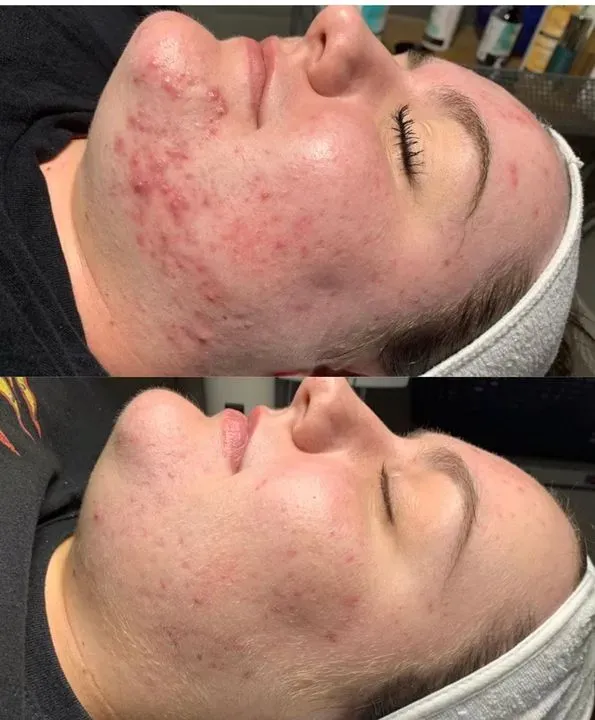 https://cdn.salonspotlight.com/photos/Ajmz09DkZf80rSjkBsCJ/bed2d712-842c-4e23-b934-65ec7ffe2b44_720x720