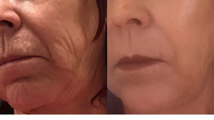 https://cdn.salonspotlight.com/photos/B0aihSTZr3NHNOli5Giz/8c9b9f28-b64e-44ff-b95b-cb9bf4097b73_720x720