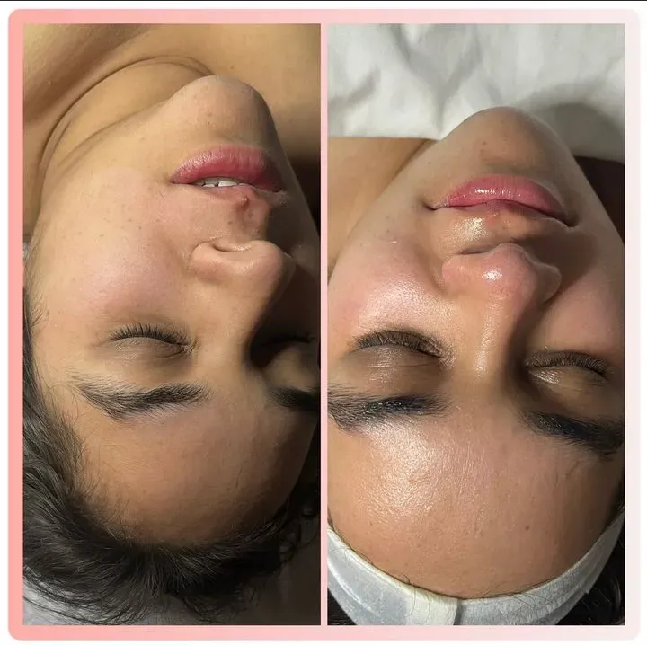 https://cdn.salonspotlight.com/photos/BoAG6wCgNN8DMh60Epjv/d4396260-0b1f-400a-a085-59f44febd36f_720x720