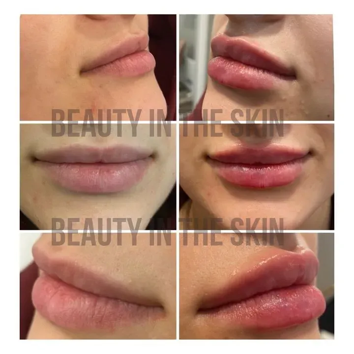 https://cdn.salonspotlight.com/photos/CVanA0mORInE9hDnoePM/1738be5f-aff4-4cdc-8b6b-6993d3a8af56_720x720