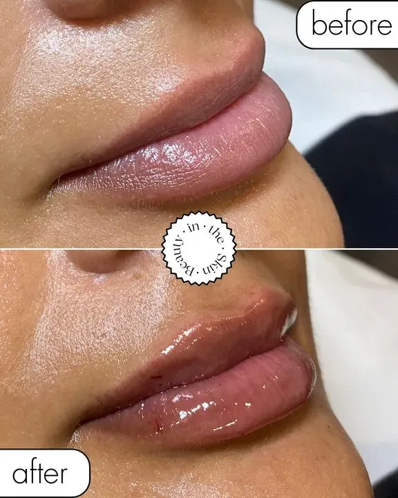 https://cdn.salonspotlight.com/photos/CVanA0mORInE9hDnoePM/84d7672c-c18c-44ef-aa9a-ad4020144688_720x720