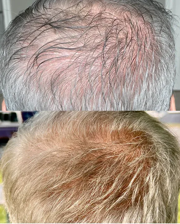 https://cdn.salonspotlight.com/photos/EGCFUacNkLf4geB0aIqX/ba0bb9f0-31cb-4d8b-b1e5-30ddf031c667_720x720