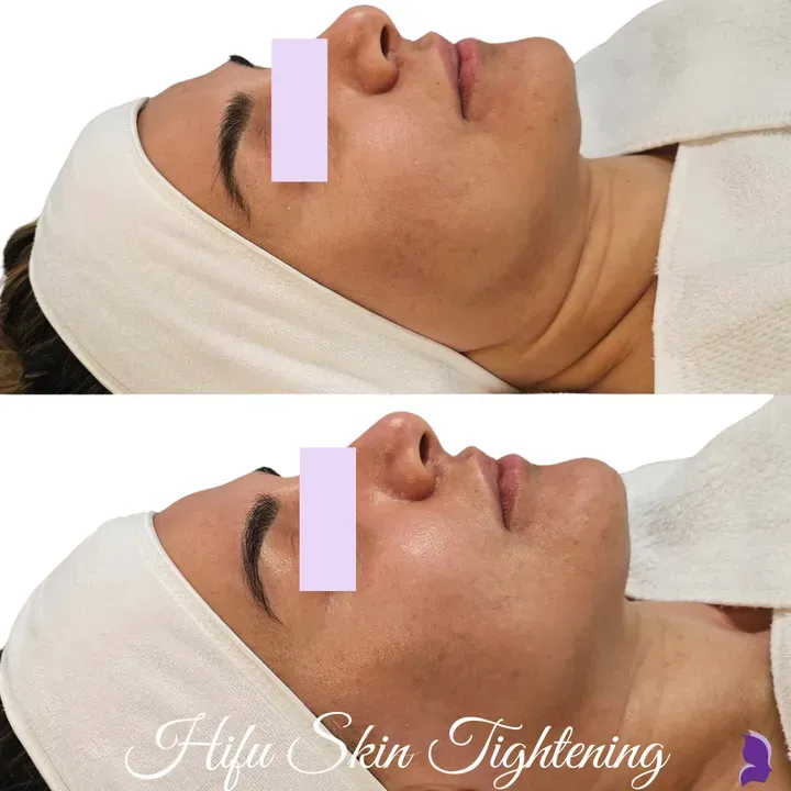 https://cdn.salonspotlight.com/photos/GPtCqdk4JFk8LSPf6v2A/0c07cc33-c443-43a3-82e1-d4c7ad288e93_720x720