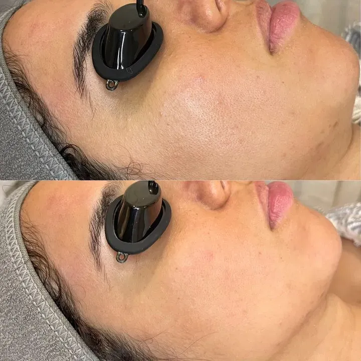 https://cdn.salonspotlight.com/photos/GdnC00OCHnL1W682EIPa/89806a8b-fa4d-489f-91ee-c91c1a9bcc9b_720x720