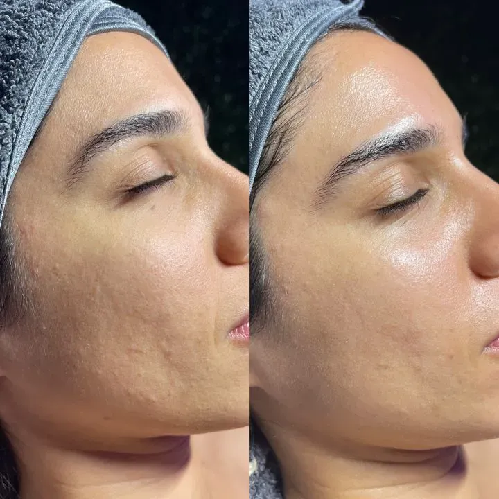 https://cdn.salonspotlight.com/photos/GdnC00OCHnL1W682EIPa/b81b4793-9011-43b2-ba95-83905d287882_720x720
