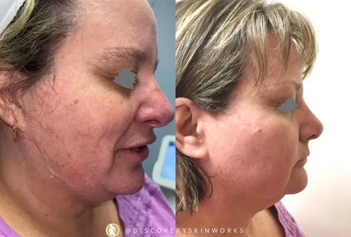 https://cdn.salonspotlight.com/photos/IODkCJYcA6CTd1R7wEdi/265fa1ac-fddc-4562-99bc-f9d6daf3f719_720x720