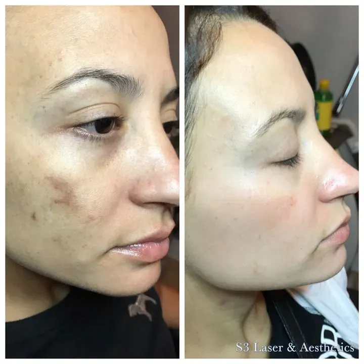 https://cdn.salonspotlight.com/photos/J7PLTnyksKH4aj85dR5V/e86807fb-8b4e-4627-8b7f-5c4ff115e65d_720x720