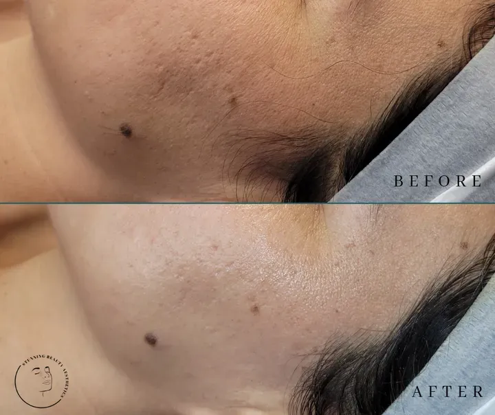 https://cdn.salonspotlight.com/photos/NKmpW6w4fAQeK5pPZdVk/a817183f-86dd-4081-9c44-2b0f749648ed_720x720