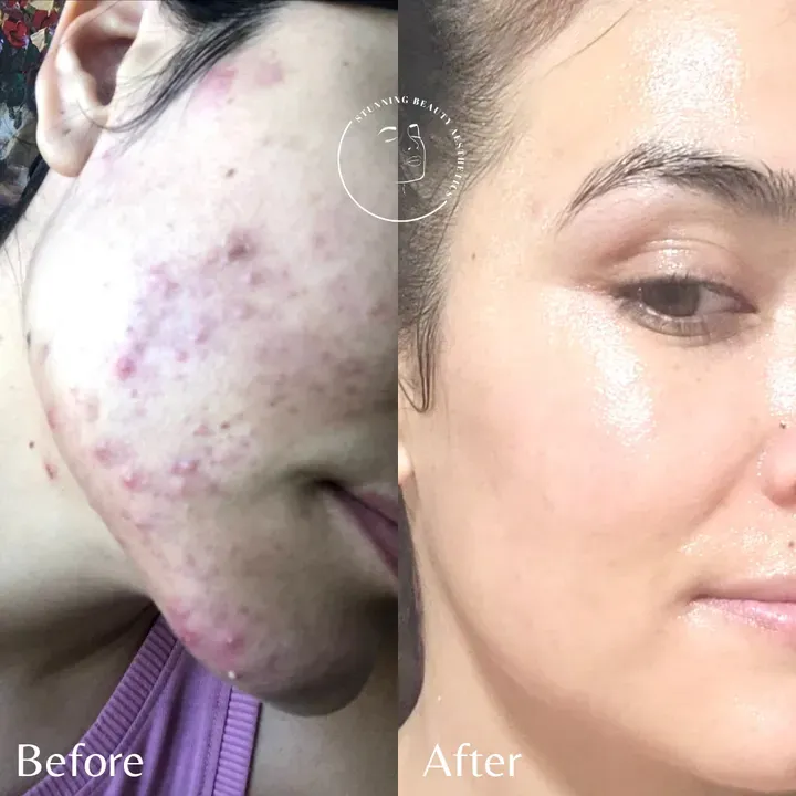 https://cdn.salonspotlight.com/photos/NKmpW6w4fAQeK5pPZdVk/b7de0263-dd43-4565-9b69-796d1d807fb1_720x720
