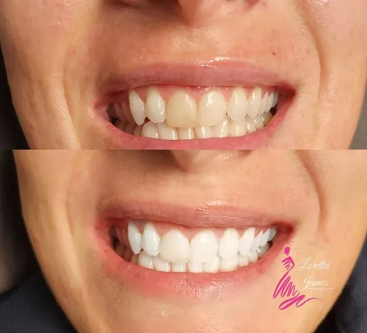 https://cdn.salonspotlight.com/photos/NfxilAQhaGxITwdc2gkB/c8d04c15-4e4a-4fe2-9a33-474223a0ea7a_720x720