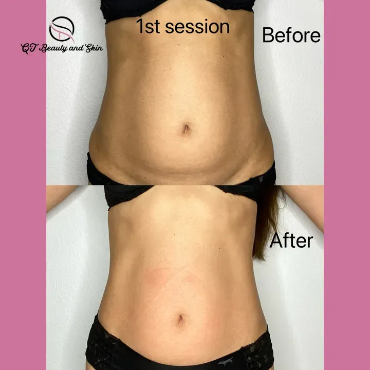 https://cdn.salonspotlight.com/photos/QAOw4GnGq5icJAMkdpTg/08371abf-b495-4336-a6b0-356c13788387_720x720