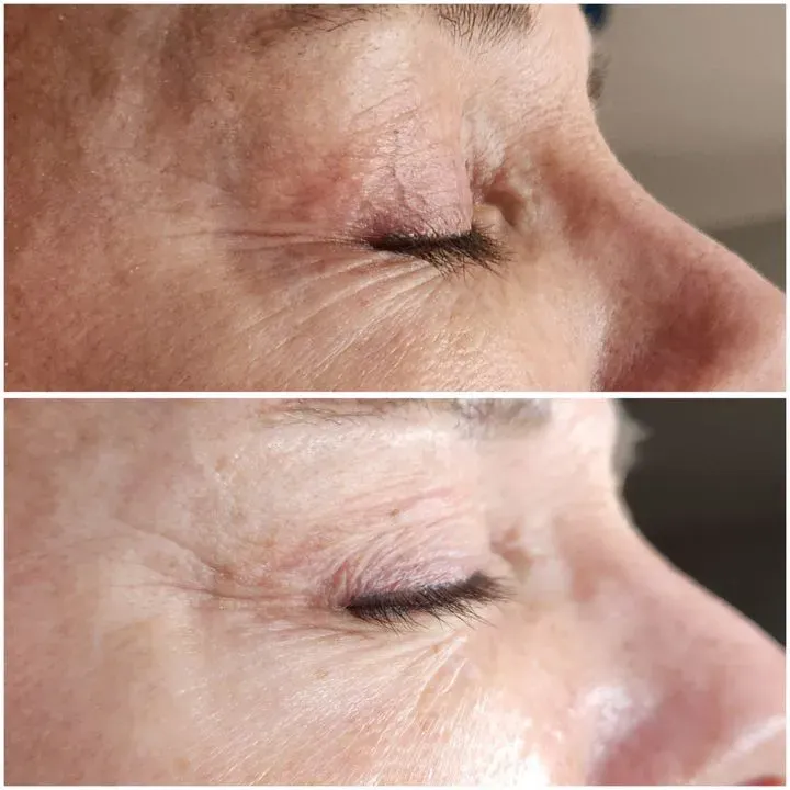 https://cdn.salonspotlight.com/photos/QXLACylbETGDv0j3tSiN/801dd669-74c0-4a92-9f92-799f8797e93a_720x720
