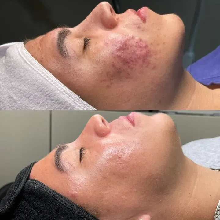 https://cdn.salonspotlight.com/photos/Qkj2ZTYgvyzhTr3nPJ2c/39531710-f4bd-4591-ba63-efd902abc9ba_720x720
