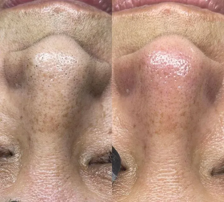https://cdn.salonspotlight.com/photos/Qkj2ZTYgvyzhTr3nPJ2c/eabebcd9-b2fc-45d8-8db9-e857daf0a910_720x720