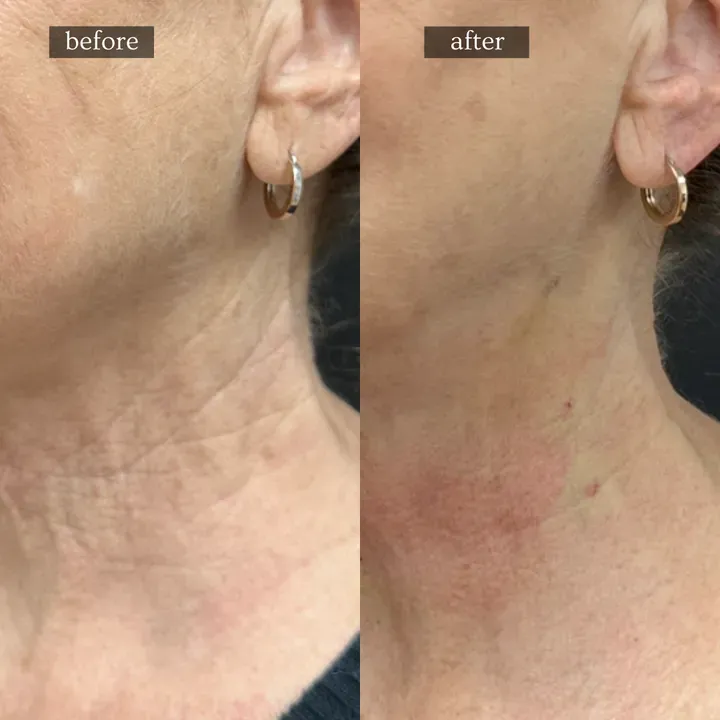https://cdn.salonspotlight.com/photos/SqLKjj33tWE3v5NNjD0H/aff66604-68a2-498d-b456-3894c2099401_720x720