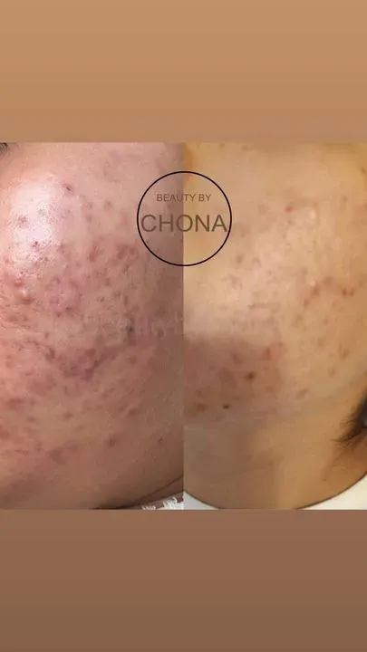 https://cdn.salonspotlight.com/photos/T7v6N4d5c3U7PL6P0cBW/337b70d4-8e89-4cb1-818e-8402f4516157_720x720