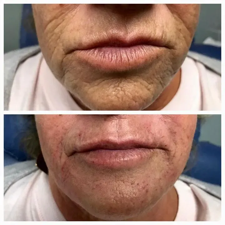 https://cdn.salonspotlight.com/photos/XrWIZiboLMClq7nNyd5d/d00b17ea-ecad-4d15-9e88-9d2a7de1553f_720x720