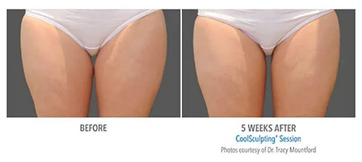 https://cdn.salonspotlight.com/photos/ZpjZcnK21gFBmwL5FjGm/1d00be0c-8f3a-4d5b-a1e6-31cd4cb905b3_720x720