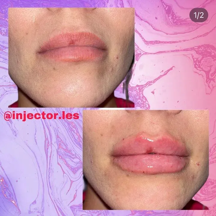 https://cdn.salonspotlight.com/photos/aQXj8B8BEbk2IKvJooHp/cf0c1105-b84e-4ed9-b0ae-977bc6b8db01_720x720