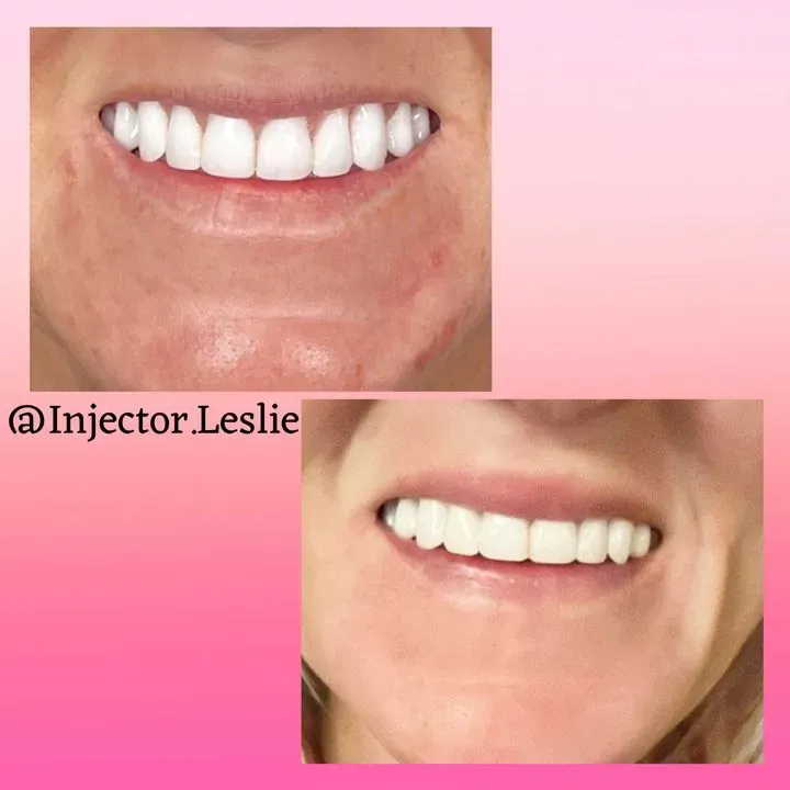 https://cdn.salonspotlight.com/photos/aQXj8B8BEbk2IKvJooHp/f68be0b7-cc6f-4551-875b-96090b098ae6_720x720