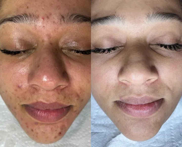 https://cdn.salonspotlight.com/photos/h6KIHFC4CWvi153L2cwF/29b6241e-fff5-4140-8a1e-aec0894025d2_720x720