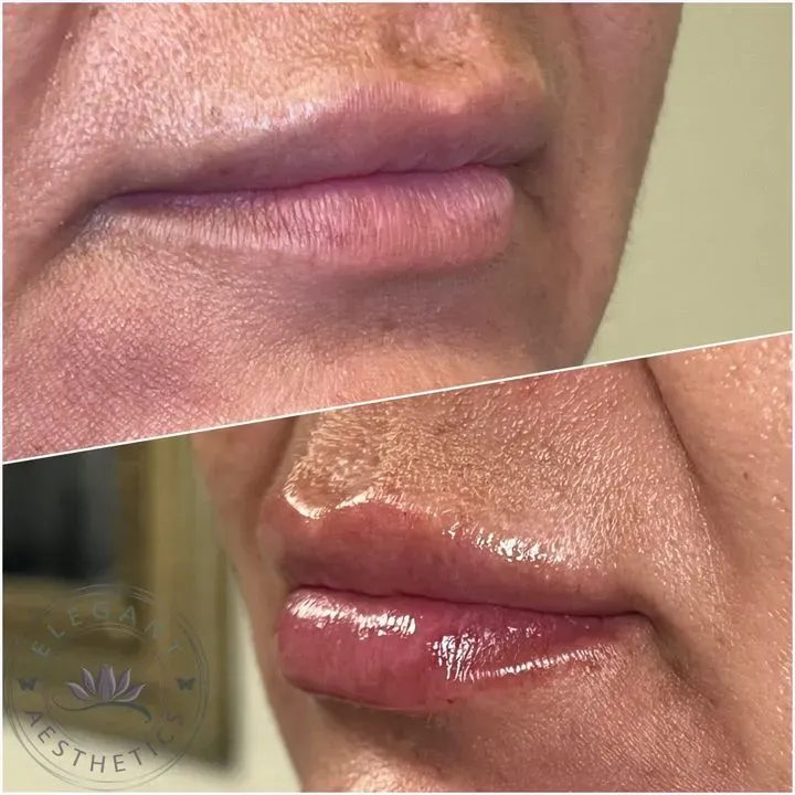 https://cdn.salonspotlight.com/photos/iOQMHgQbfdqVDrN40YwC/253373c4-70c9-4866-abd5-a022173c773c_720x720
