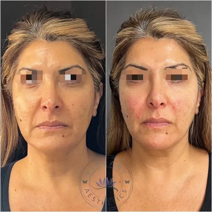 https://cdn.salonspotlight.com/photos/iOQMHgQbfdqVDrN40YwC/b1c235fe-9cbe-418f-8956-e2401219151f_720x720