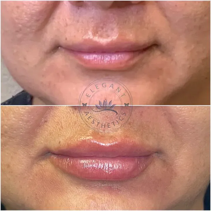 https://cdn.salonspotlight.com/photos/iOQMHgQbfdqVDrN40YwC/b4838c84-bdac-4816-a7b7-2274f926bdaa_720x720
