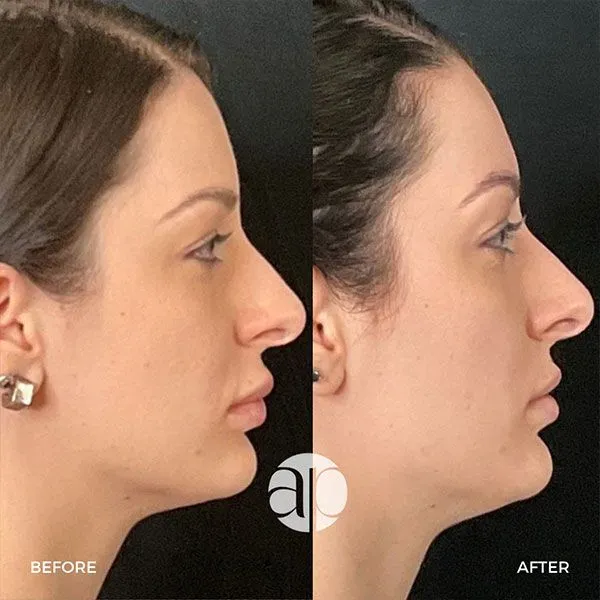 https://cdn.salonspotlight.com/photos/jifMnF0O4OU49QN1927h/4526bbf5-8e8e-470a-a1cd-0f1fbde99db8_720x720