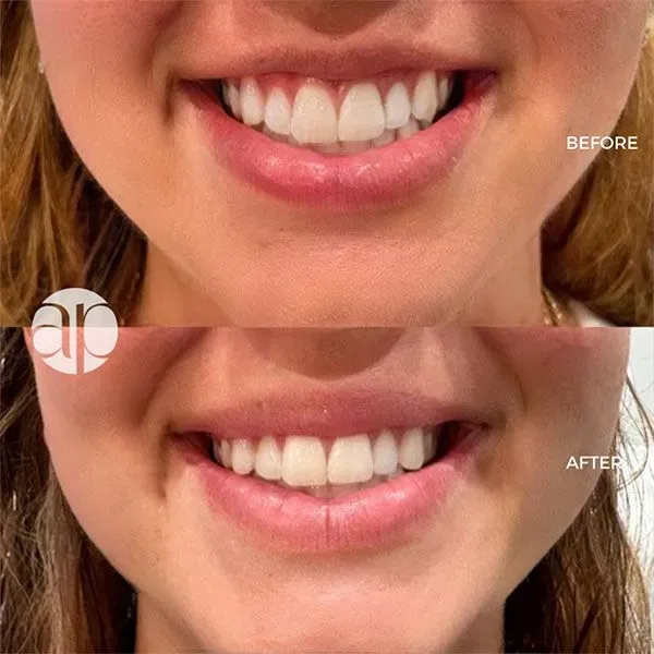 https://cdn.salonspotlight.com/photos/jifMnF0O4OU49QN1927h/c6597474-4f5b-41e6-b372-63cb7a35db31_720x720