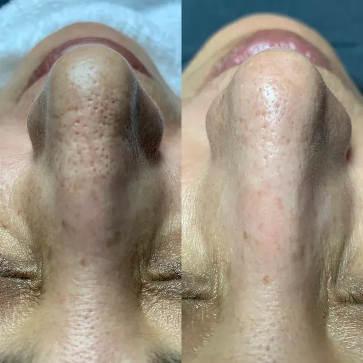 https://cdn.salonspotlight.com/photos/jn6ZE6cviJgj0z7OycPY/04ade8ff-53f0-4573-8b57-f85e1d92e1d5_720x720