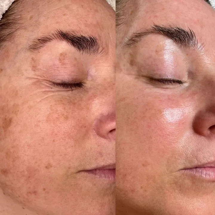https://cdn.salonspotlight.com/photos/l7HN5xPuSXf3kCD2UHXo/50bb973d-9485-41de-b9e7-49b608aa8f61_720x720