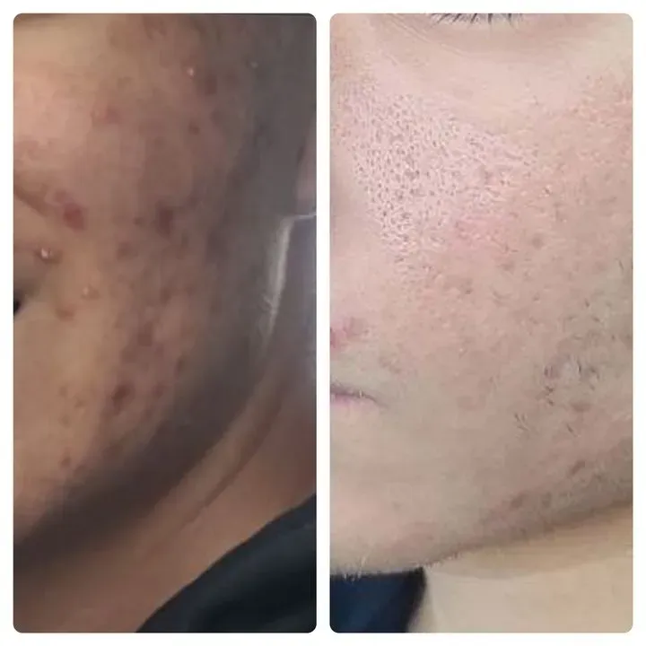 https://cdn.salonspotlight.com/photos/nxo1kGqjaw3BZdSEprWo/bfe33ff2-8558-4a7e-a7a8-6f301087cce2_720x720