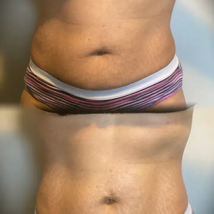 https://cdn.salonspotlight.com/photos/ofxYZOsO9vpNvSNYmhVE/80d8251e-e9fc-43e6-a306-be81ee8566a5_720x720