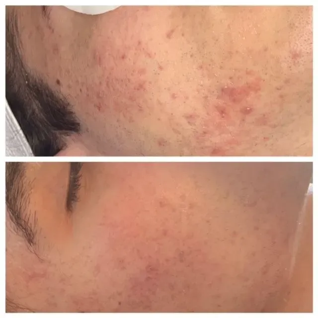 https://cdn.salonspotlight.com/photos/pdcbuOOypZEUol4OjFSM/67f683a5-30c7-45cf-a9fa-ea3c7f2e7695_720x720