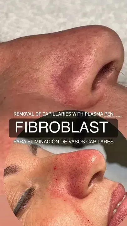 https://cdn.salonspotlight.com/photos/pudI1bLw868COF4FO9nf/adf930cf-fec5-4524-a39c-1a3b520cb9c6_720x720