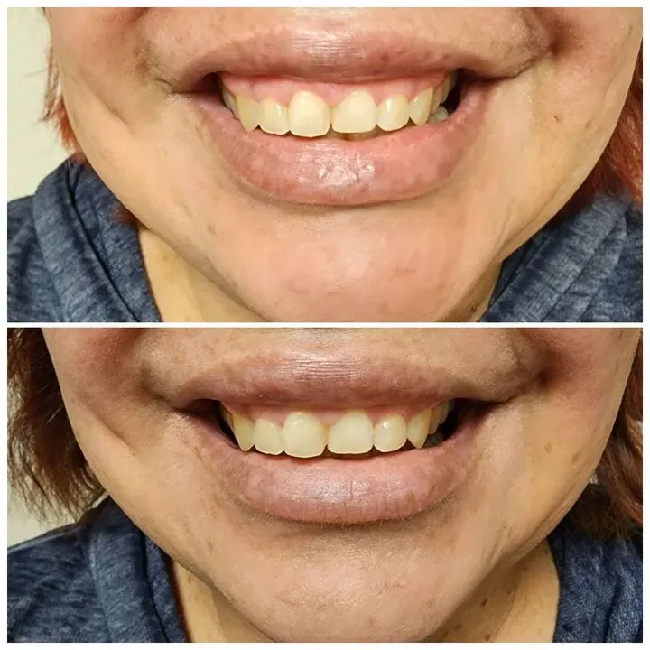 https://cdn.salonspotlight.com/photos/rYLJSLKJGD1PdB0V3RFU/99ec1961-0811-48e6-8bb7-7638081bf3de_720x720