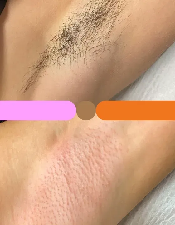 https://cdn.salonspotlight.com/photos/s4ywUKn0yJz2YZbkbSzL/7315b156-764b-44a6-b90a-bdf2965004a3_720x720