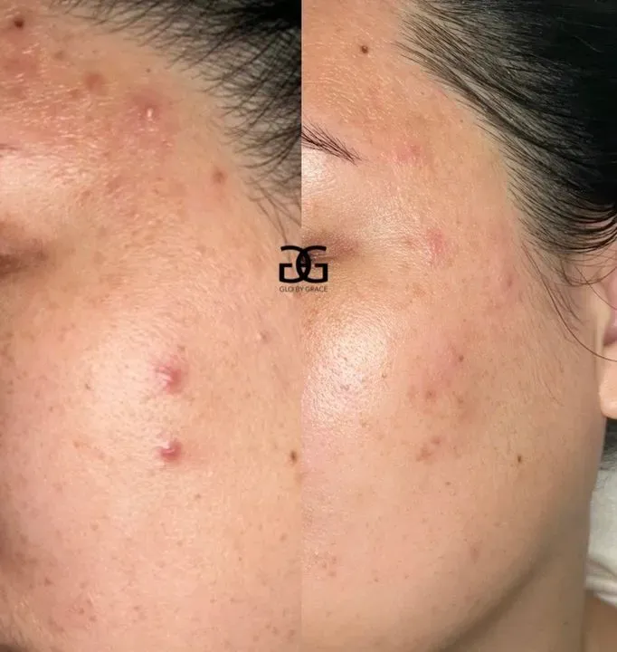 https://cdn.salonspotlight.com/photos/subpD0bjSPMf1BBrT2JG/2e258a2a-6c7d-44e6-a6a8-390aeaa423b3_720x720