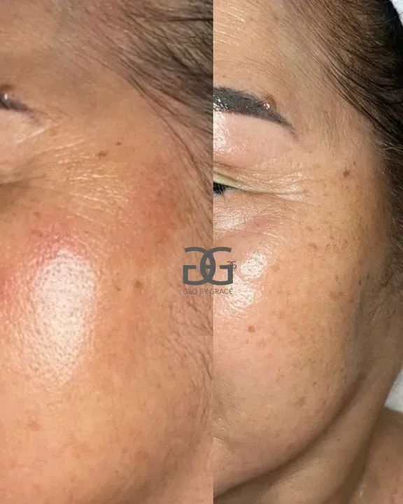 https://cdn.salonspotlight.com/photos/subpD0bjSPMf1BBrT2JG/37c1bd8d-5cb8-4316-b2d1-5936b71d2a40_720x720